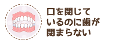 口を閉じているのに歯が閉まらない